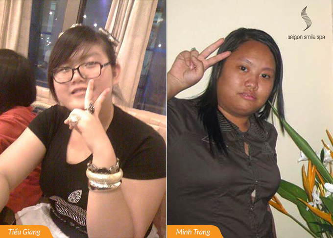 Béo bẩm sinh 2 bà mẹ 9X làm thế nào để giảm được hơn 20kg?