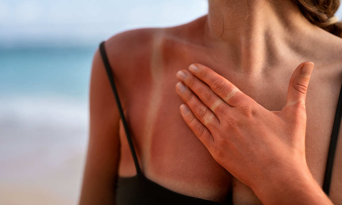 Bạn có biết ăn gì giúp da chống nắng khi đi du lịch?