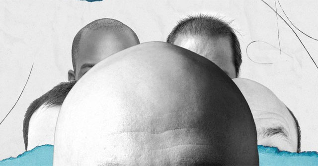 Tại sao đàn ông thường hói đầu còn phụ nữ thì hiếm khi?