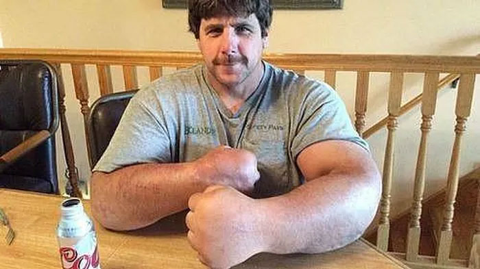 Người đàn ông có bàn tay to - Popeyes ngoài đời