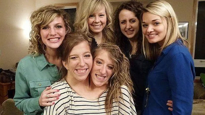 Cặp song sinh dính liền