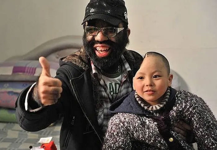 Người đàn ông nhiều lông nhất